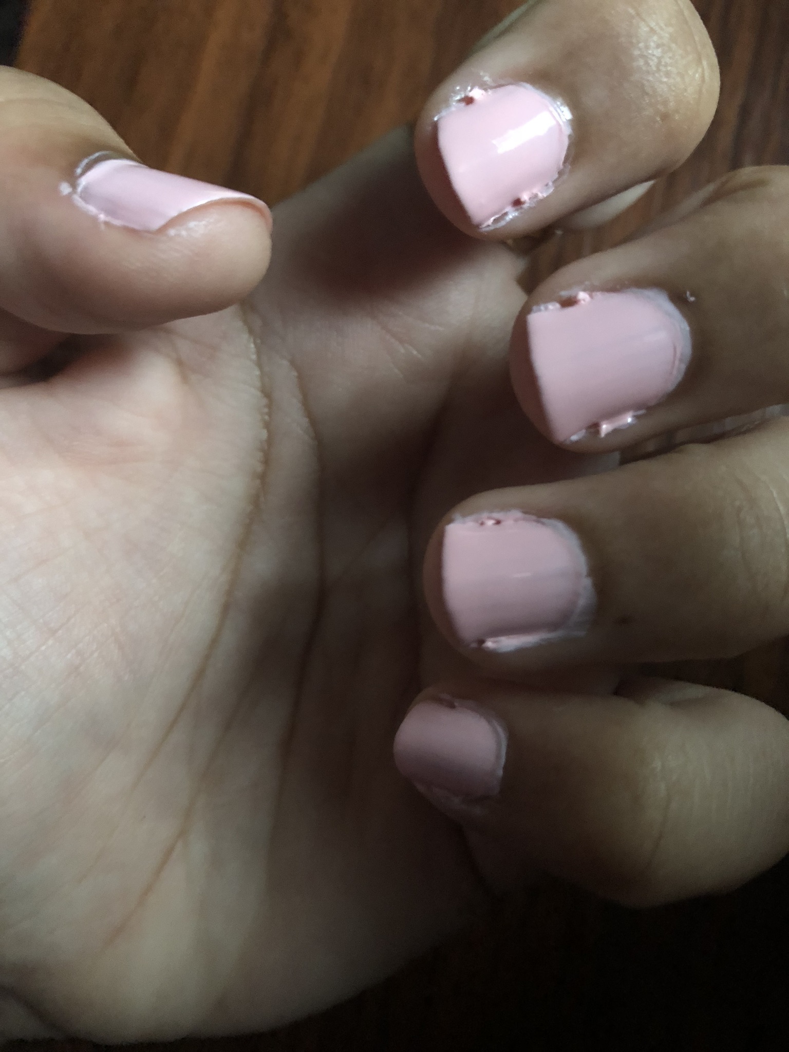 Why Is the Skin Under My Fingernails Longer Than My Nails? We Asked a Pro -  POPSUGAR Australia